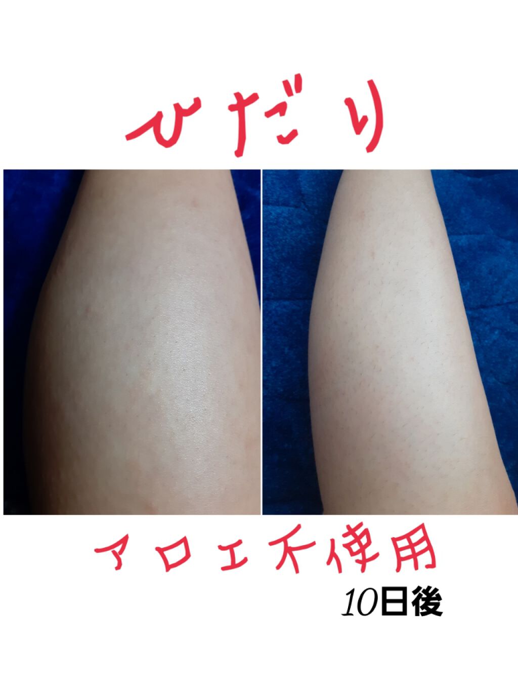 マイルド&モイスチャーアロエジェル/ネイチャーリパブリック/ボディローションを使ったクチコミ(4枚目)