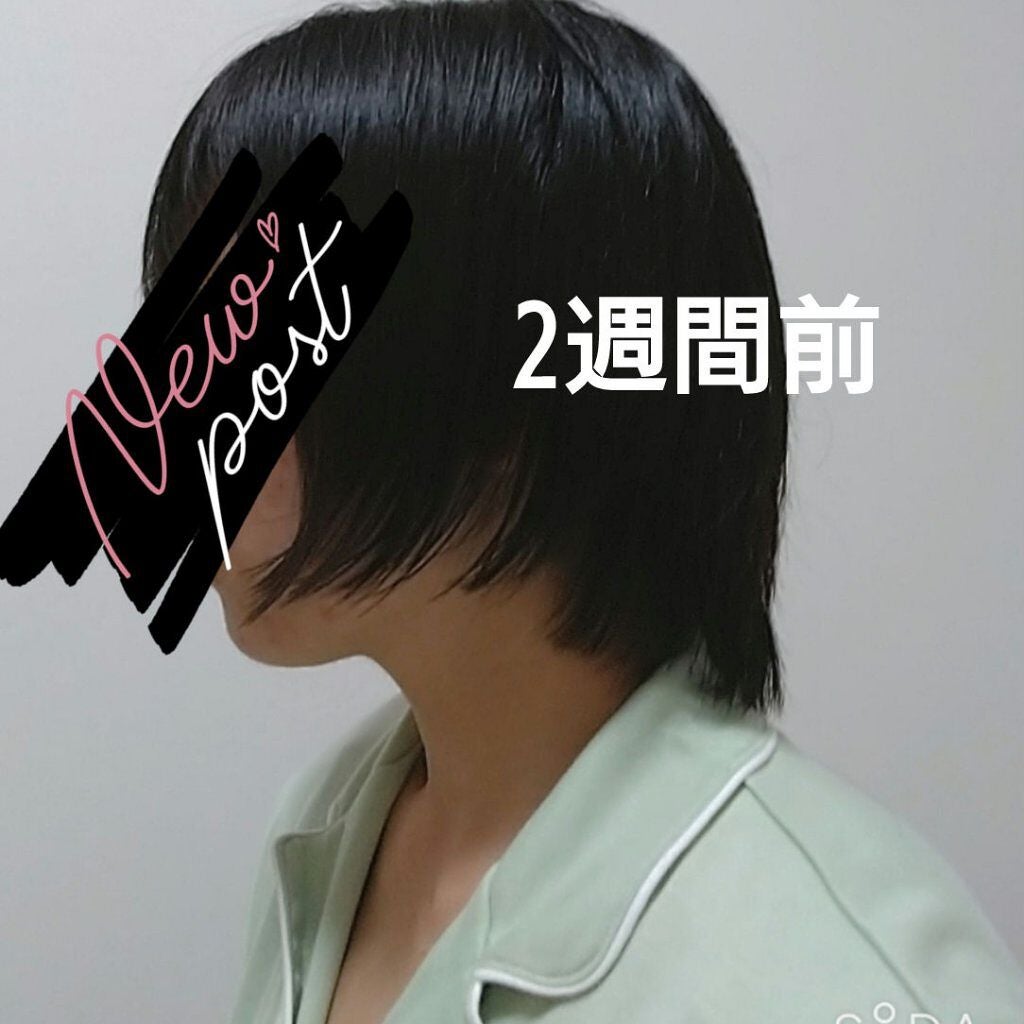 亜鉛/Dear-Natura (ディアナチュラ)/健康サプリメントを使ったクチコミ(2枚目)