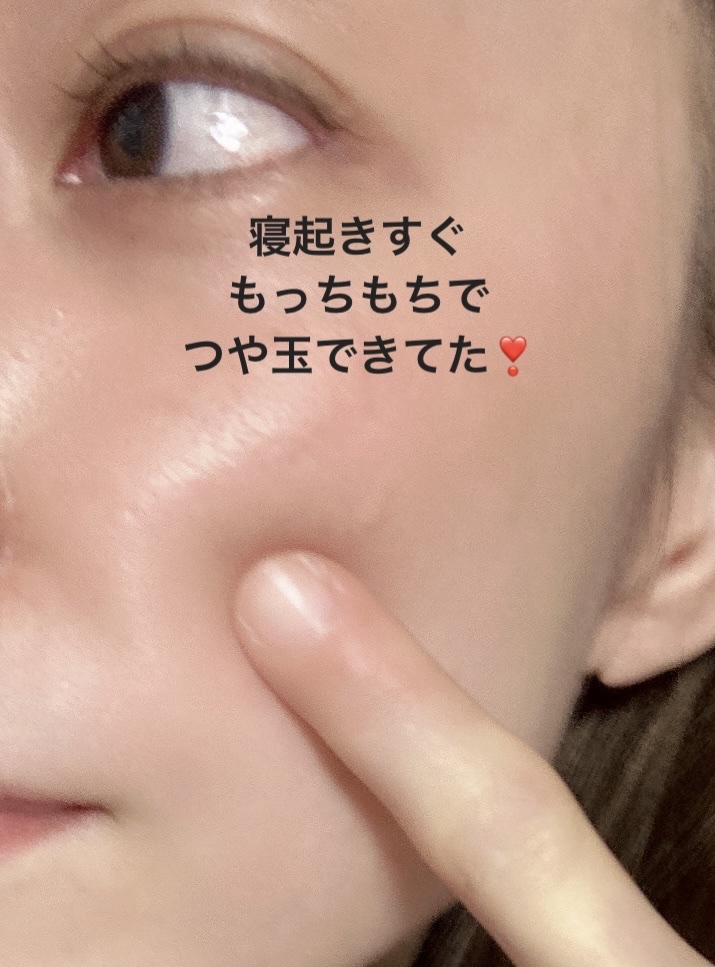 セラミューン™ハイドレーティングクリームスキン /BIOHEAL BOH/乳液を使ったクチコミ（3枚目）