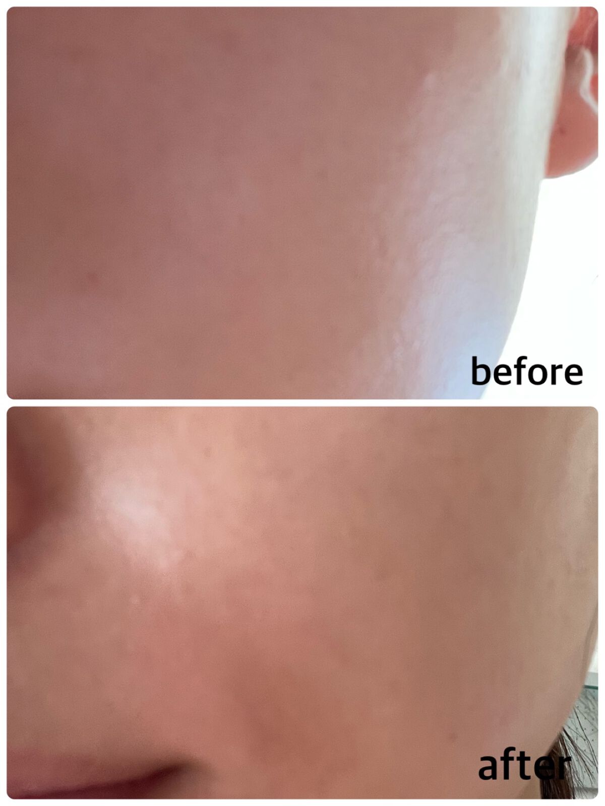 バイオ コンディショニング エッセンス/IOPE/ブースター・導入液を使ったクチコミ（3枚目）