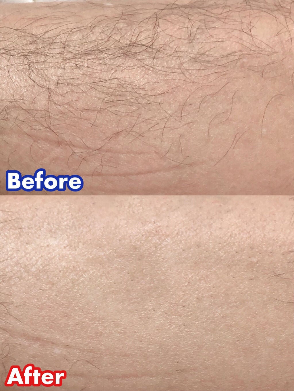 VIOフェリエ ES-WV61/Panasonic/シェーバーを使ったクチコミ(5枚目)