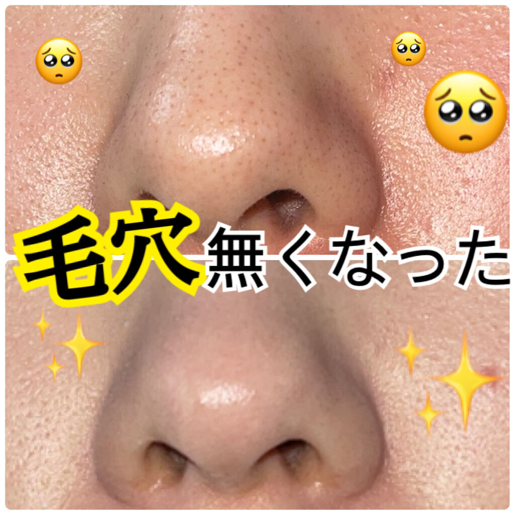 たまご化粧水/ココエッグ/化粧水を使ったクチコミ（1枚目）