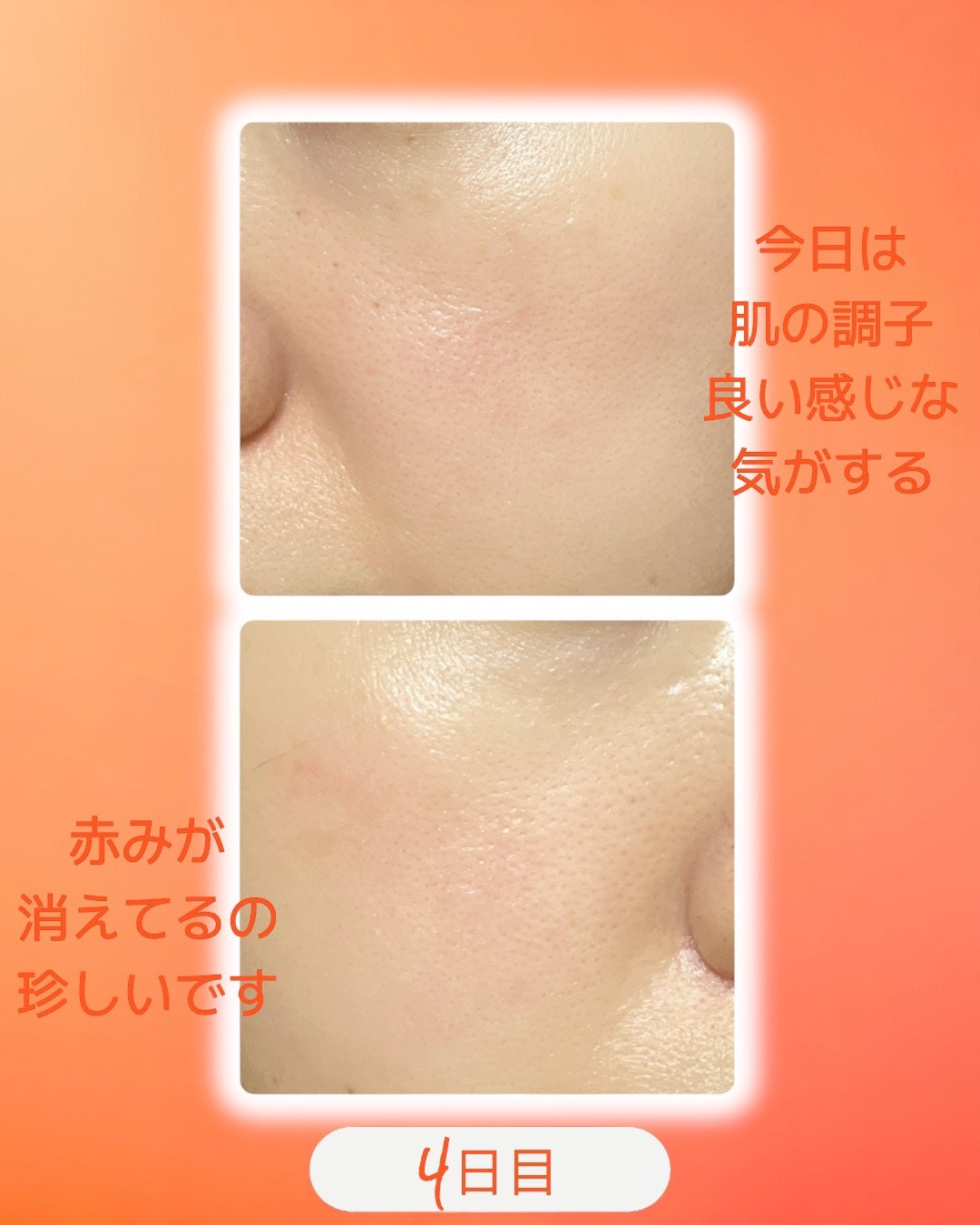 TXトーニングデイリーマスク/VT/その他スキンケアを使ったクチコミ(2枚目)