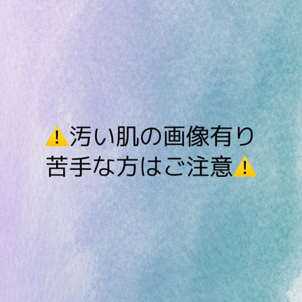 ニキビあとケアジェル/アットノン/その他スキンケアを使ったクチコミ(2枚目)
