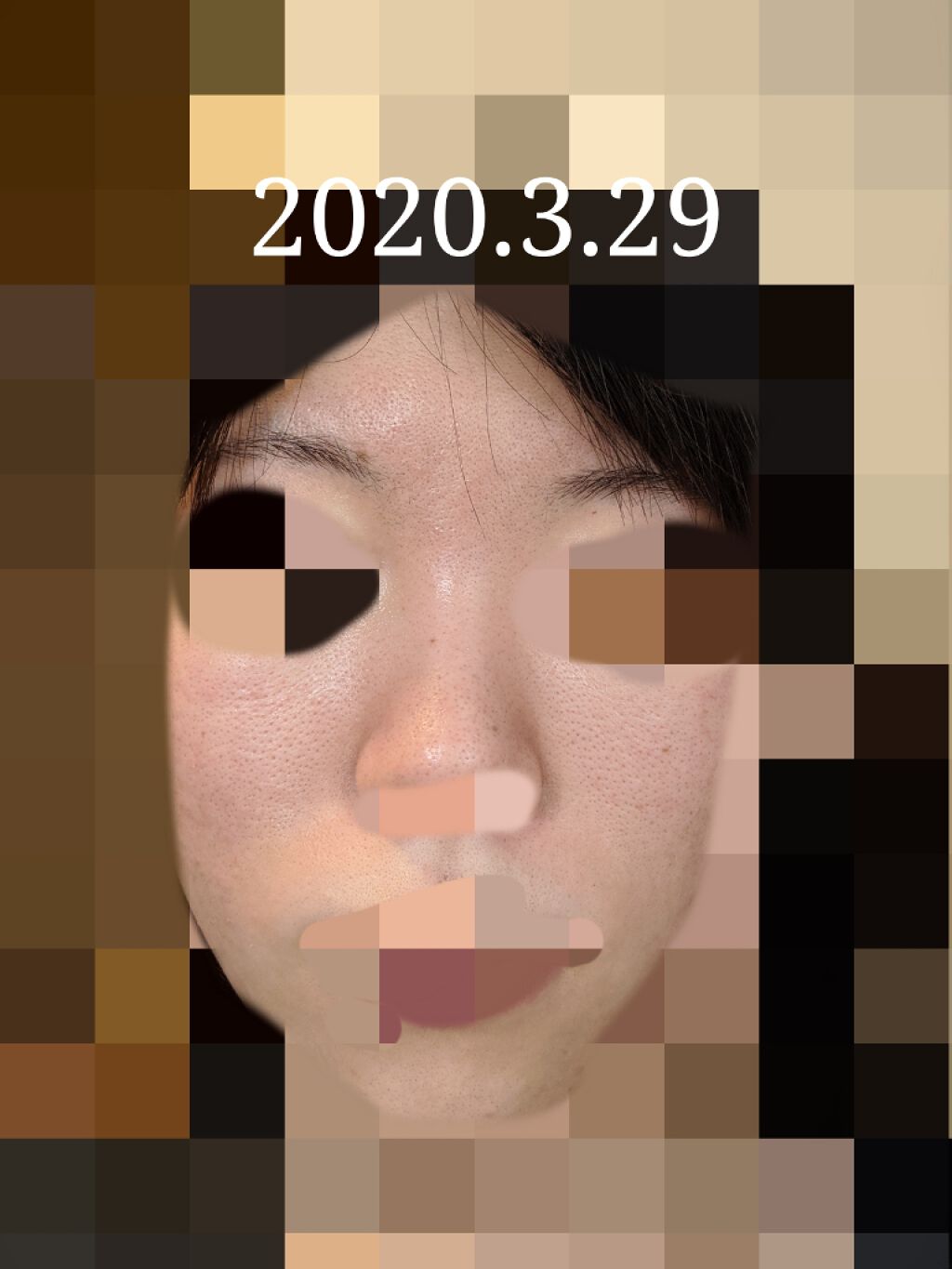 エバレッシュホワイトEXⅡ(医薬品)/matsukiyo/その他を使ったクチコミ(1枚目)