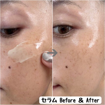 ヴィーガンリポソームレチノールセラム/SKIN&LAB/美容液を使ったクチコミ(6枚目)