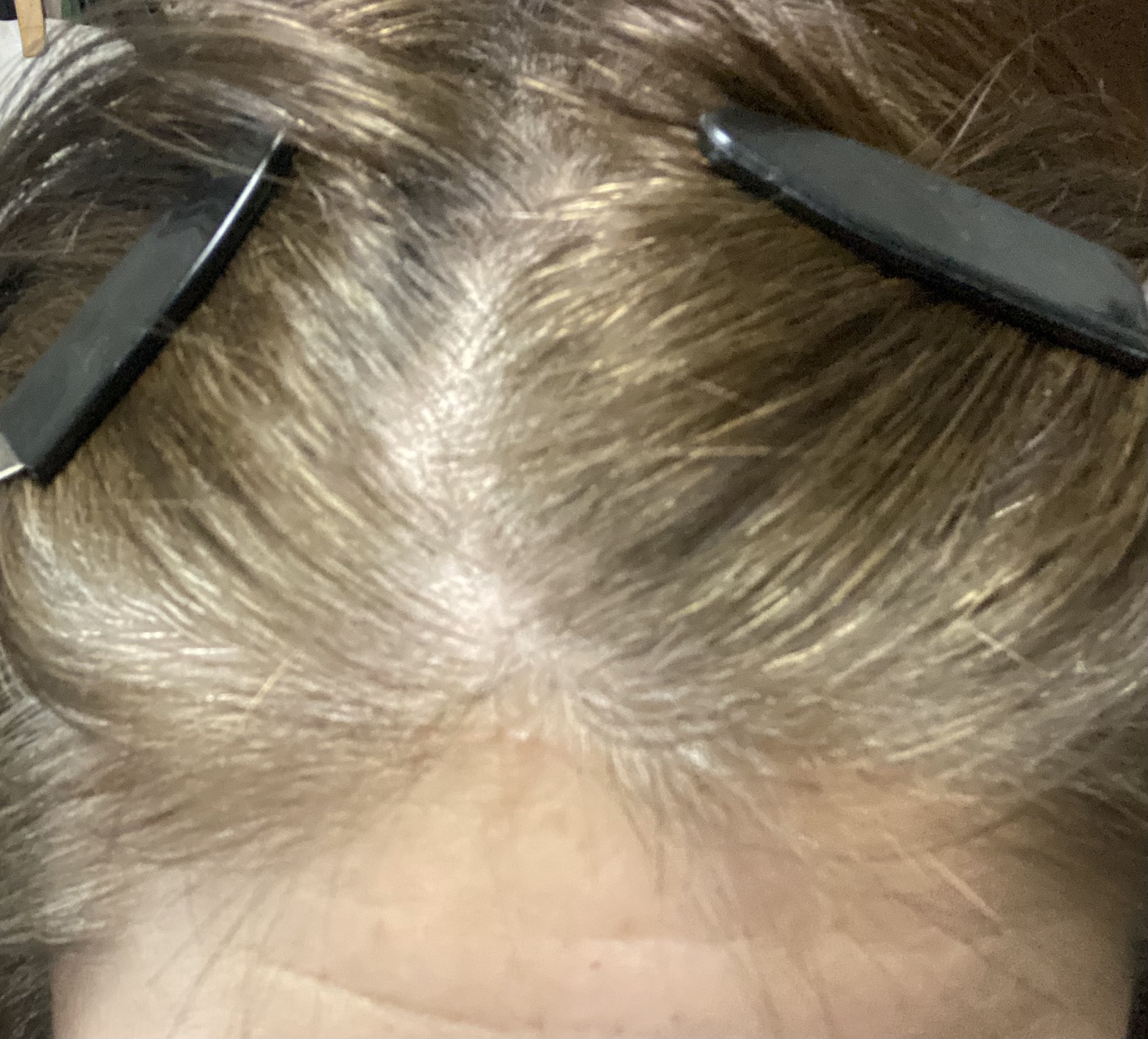 ウエラトーン ツープラスワン クリームタイプ 6CB/ウエラ/ヘアカラーを使ったクチコミ（3枚目）