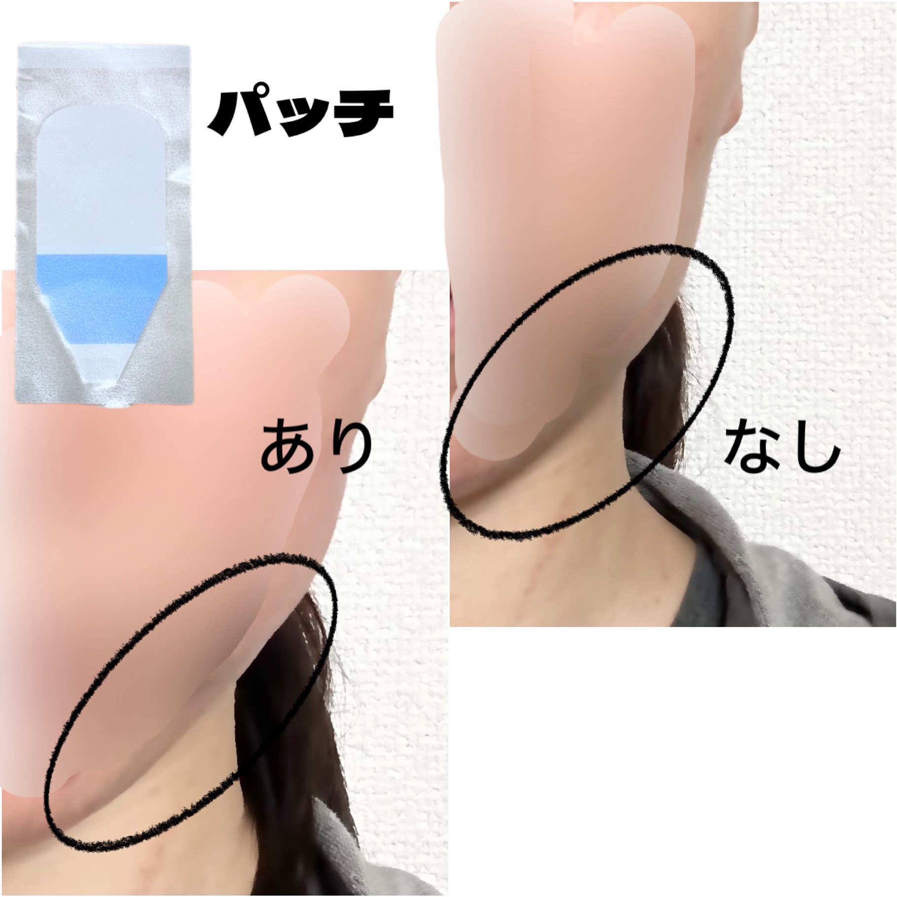 リフターンバンド/リリーイブ/その他化粧小物を使ったクチコミ（2枚目）