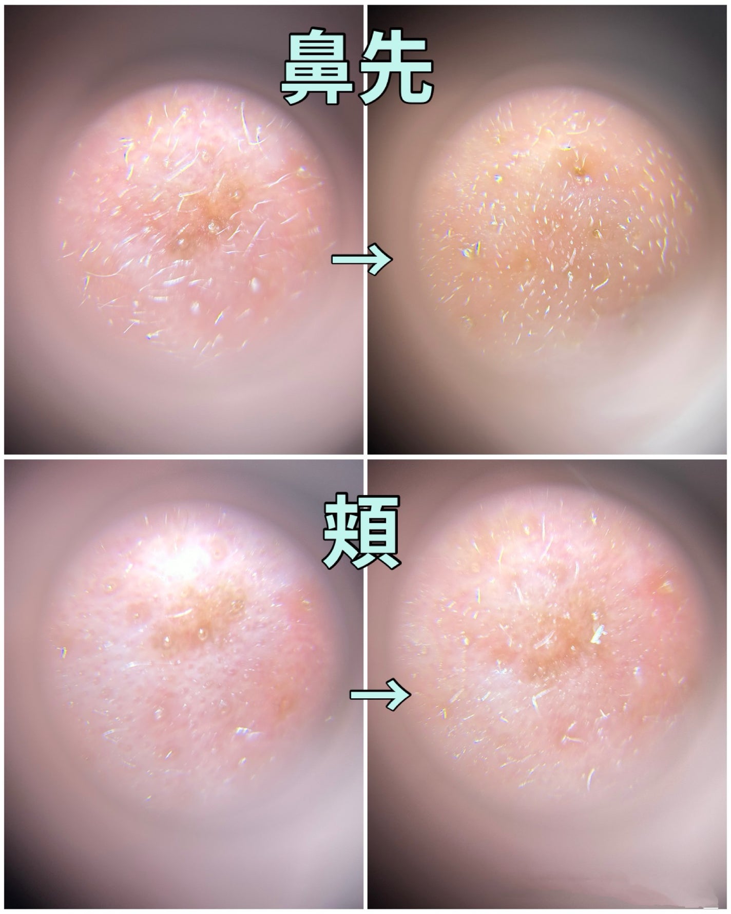 リードルショット300/VT/美容液を使ったクチコミ(6枚目)