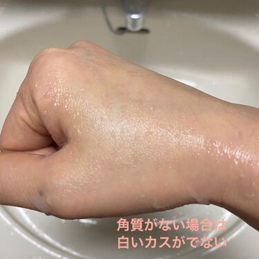 ピーリングジェル ベジスキンの使い方を徹底解説 ども ぺーです 今日はベジスキンピーリング By ぺー 敏感肌 30代前半 Lips