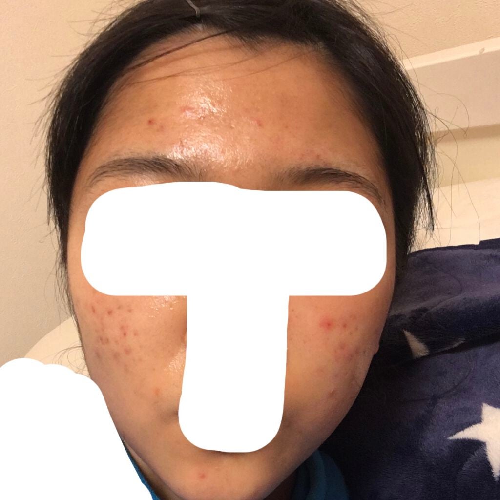 モイスチュア インストール/カルテHD/オールインワン化粧品を使ったクチコミ(1枚目)