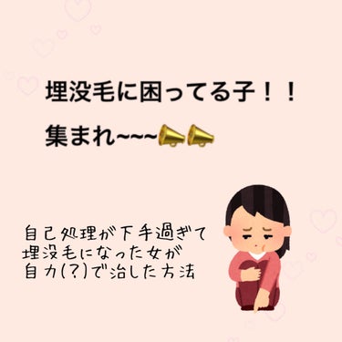 お久しぶりです。2回目の投稿、ななです👶💭🤍


1ヶ月ほど前に自分が埋没毛になっている事に気付きました…


原因やらなんやらを調べて見ると自己処理が原因で古い角質が残ってそこに毛が埋まっちゃう…みた