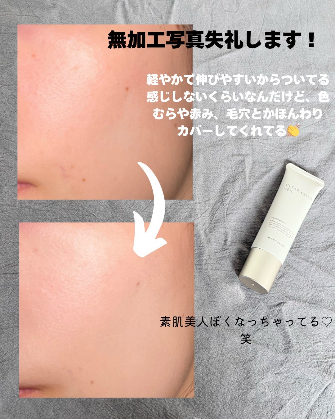 薬用クリアエステヴェール/Macchia Label/リキッドファンデーションを使ったクチコミ(4枚目)