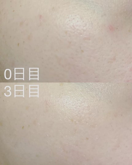 を使ったクチコミ(2枚目)