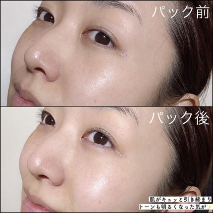 セッコク蘭エイジングケアマスクα/DR PLANT/シートマスク・パックを使ったクチコミ(4枚目)