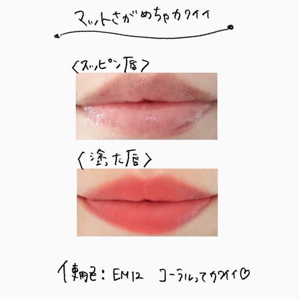 ããðå
çŸå®¹éšå¡ on LIPS ã.INTOUã¹ãŒããŒããããªãã&ããŒã¯ãããïŒæµ·å€ã§è©±é¡æ²ž..ãïŒ6æç®ïŒ