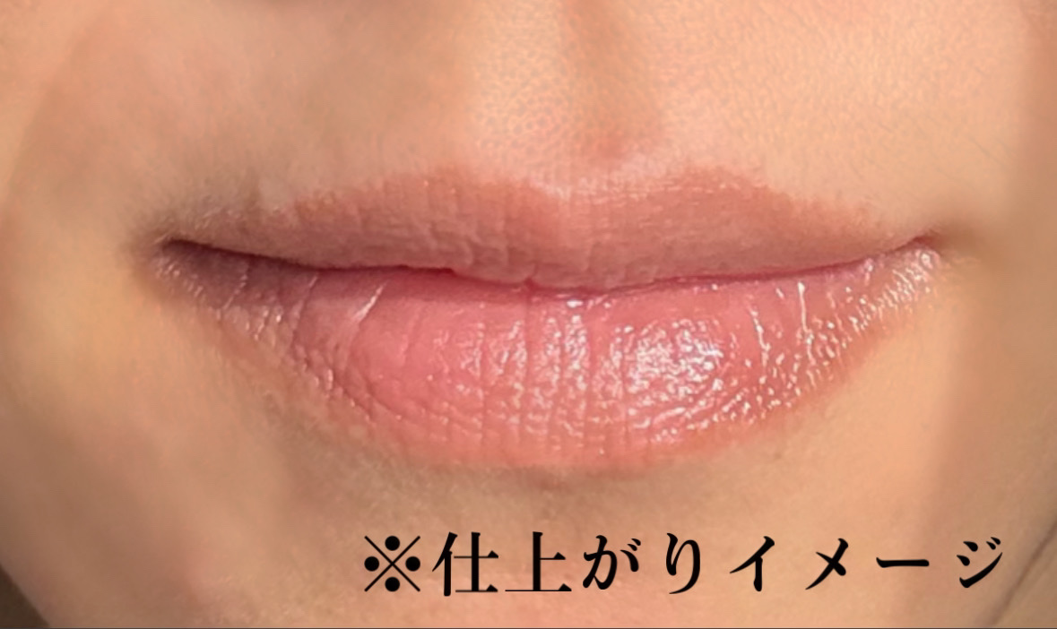 ユースキン メディカルリップスティック/ユースキン/リップクリームを使ったクチコミ（3枚目）