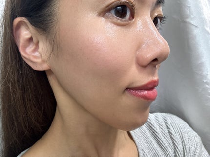 イルミグラフェイシャルシートマスク/IVIHI/シートマスク・パックを使ったクチコミ(5枚目)