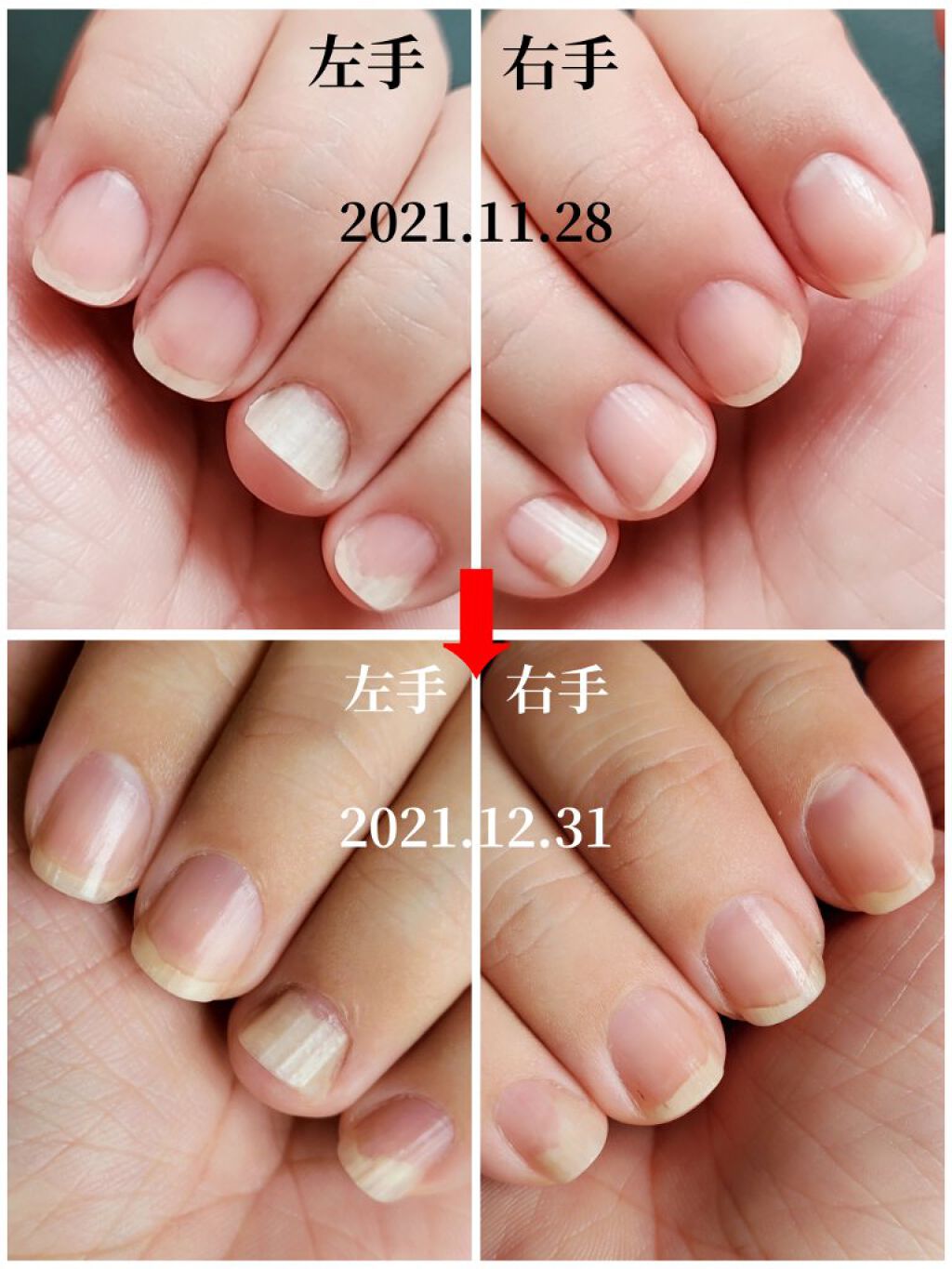 エテュセ クイックケアコート/ettusais/ネイルオイル・トリートメントを使ったクチコミ（3枚目）