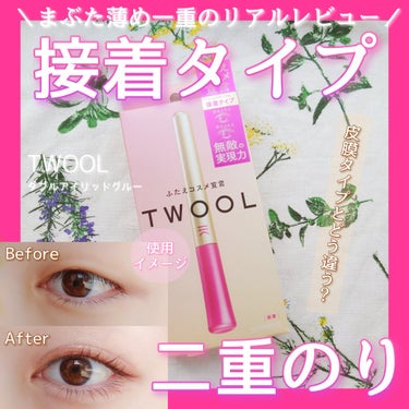 TWOOL ダブルアイリッドグルー/SHOBIDO/二重まぶた用アイテムを使ったクチコミ（1枚目）