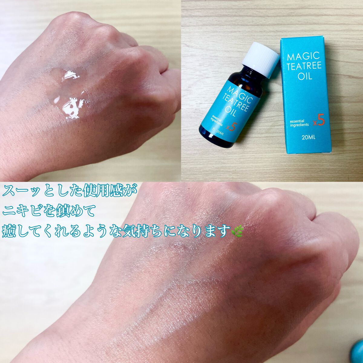 マジックティーツリーオイル/ブラン/フェイスオイルを使ったクチコミ(2枚目)