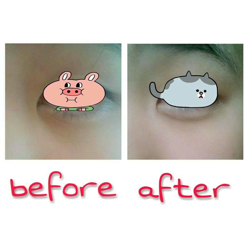 エスポルール コンシーラー&ハイライト/エスポルール/リキッドコンシーラーを使ったクチコミ(4枚目)