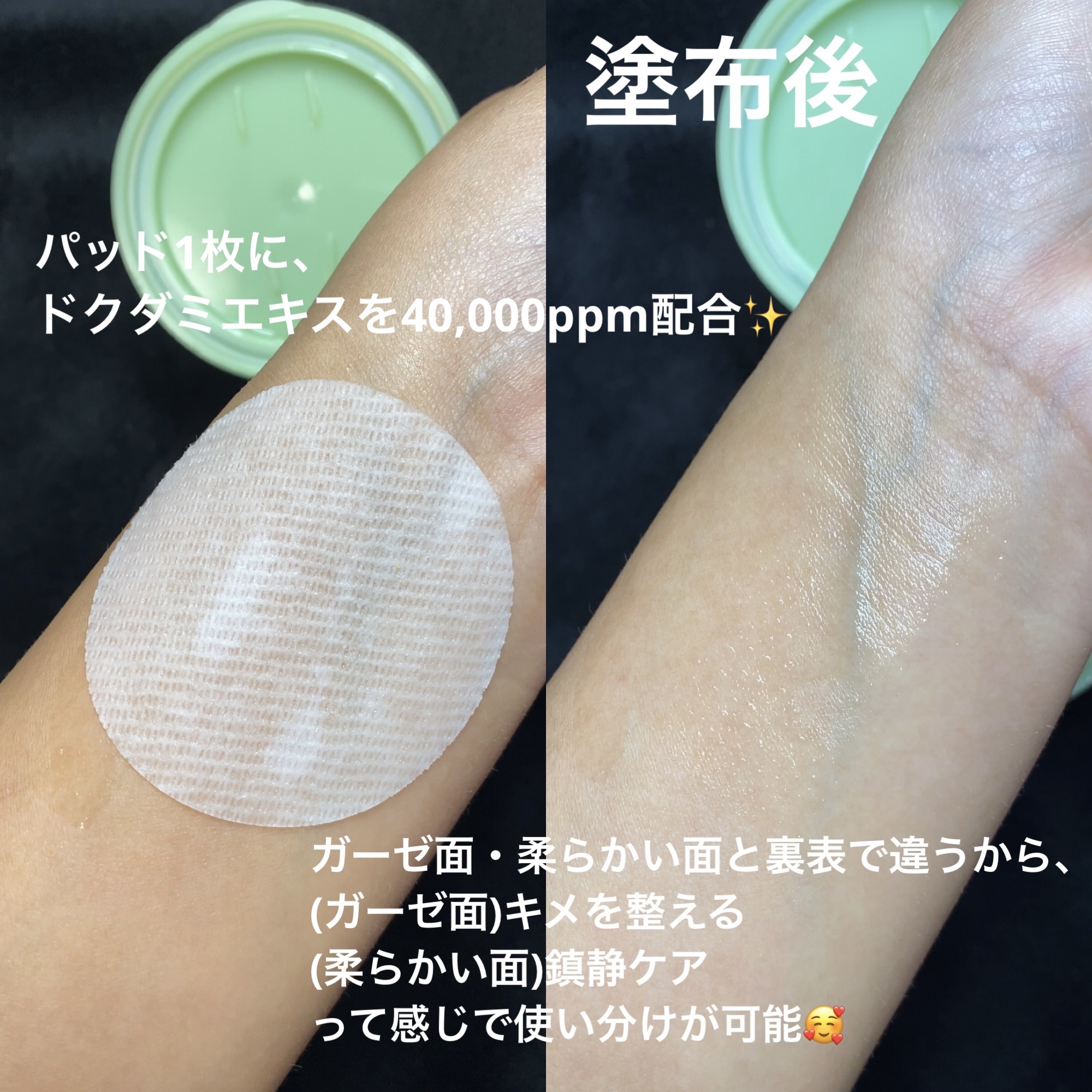 ドクダミカーミングタッチスポットパッド/Abib /トナーパッドを使ったクチコミ（2枚目）