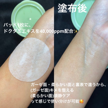 ドクダミカーミングタッチスポットパッド/Abib /トナーパッドを使ったクチコミ(2枚目)