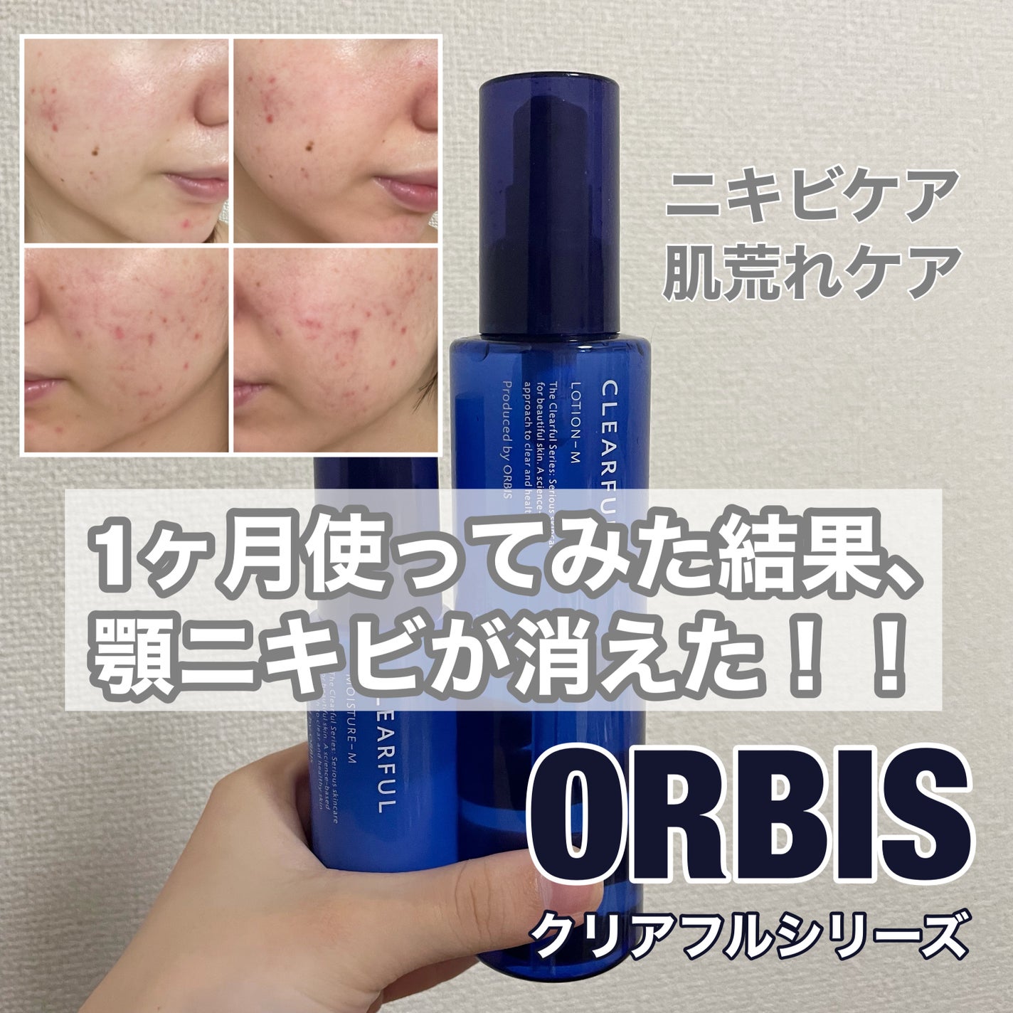 クリアフル ローションM(しっとりタイプ)/オルビス/化粧水を使ったクチコミ(1枚目)