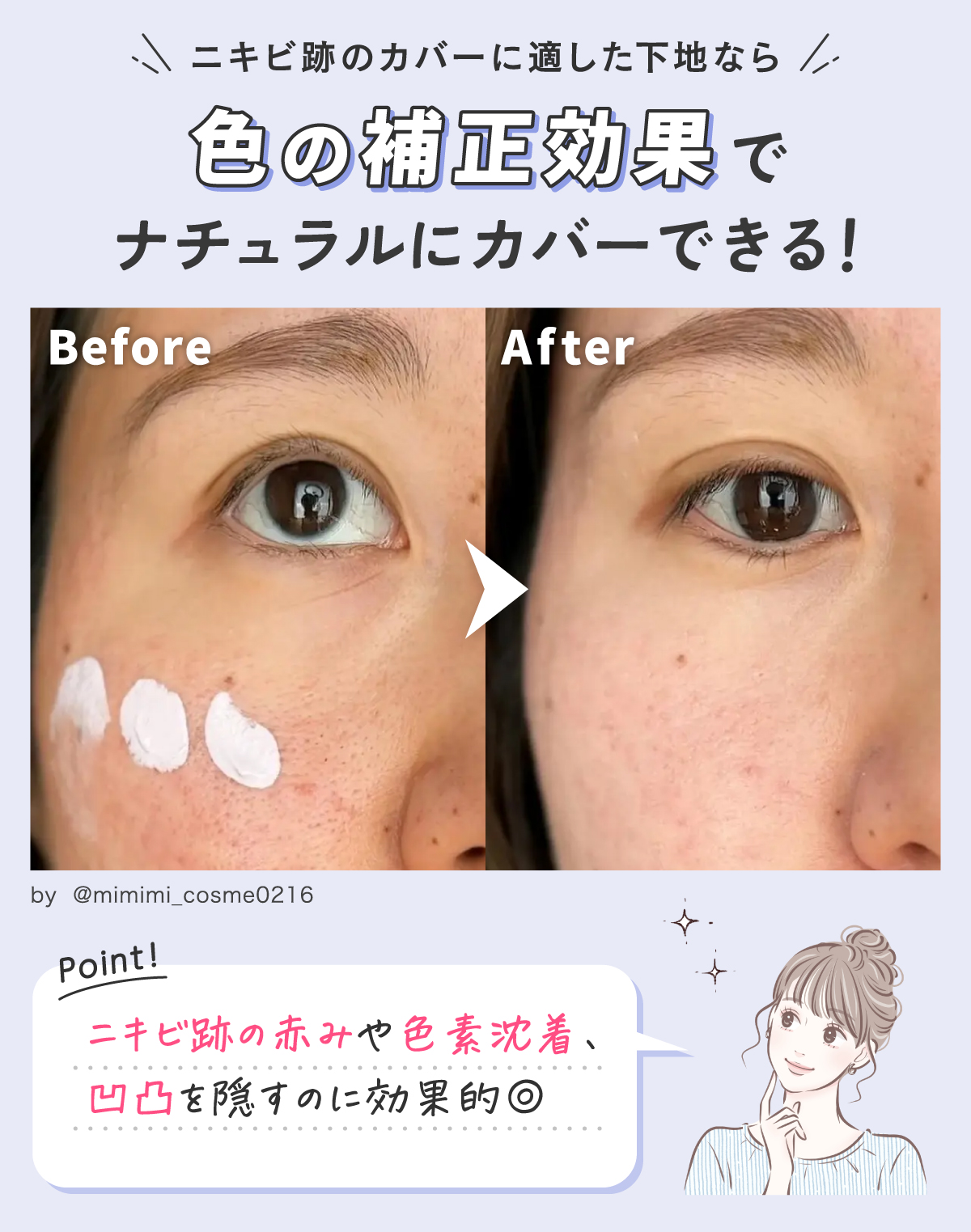 ニキビ跡のカバーに適した下地なら色の補正効果でナチュラルにカバーできる！ニキビ跡の赤みや色素沈着、凹凸を隠すのに効果的◎