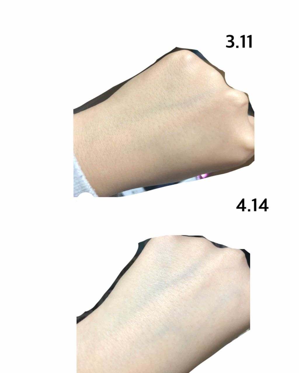 薬用 しみ 集中対策 美容液/メラノCC/美容液を使ったクチコミ(1枚目)