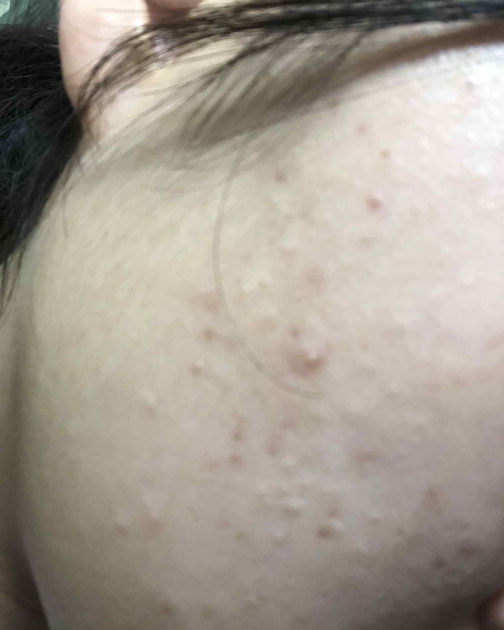 明色美顔水 薬用化粧水/美顔/化粧水を使ったクチコミ（2枚目）