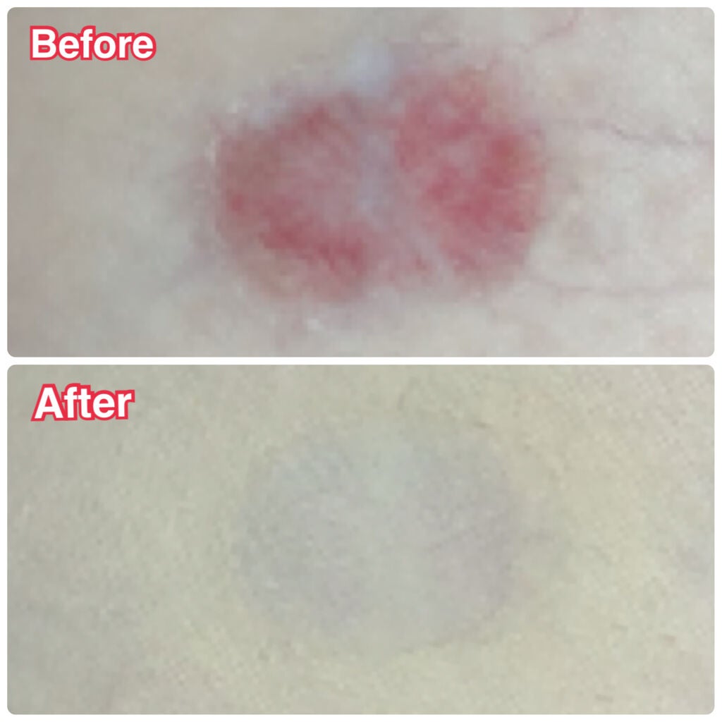 マーシュフィールド SC ボディカバーファンデN/マーシュ・フィールド/クリーム・エマルジョンファンデーションを使ったクチコミ(6枚目)