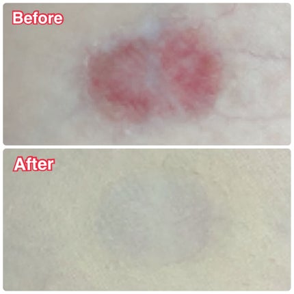 マーシュフィールド SC ボディカバーファンデN/マーシュ・フィールド/クリーム・エマルジョンファンデーションを使ったクチコミ(6枚目)