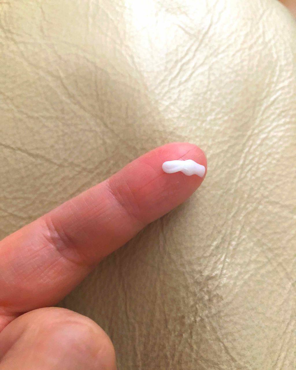 メディカルクリームc(医薬品)/メンソレータム アクネス25/その他を使ったクチコミ(2枚目)