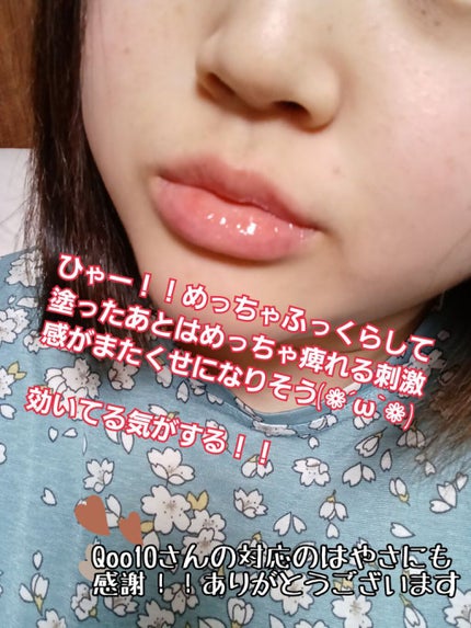 空良 on LIPS 「唇が痺れる強プランパー!!ビリビリかんがまたくせになりそう👄👄..」(4枚目)