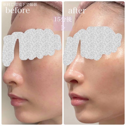 デュイセル プライベートケアマスク/DEWYCEL/シートマスク・パックを使ったクチコミ(4枚目)