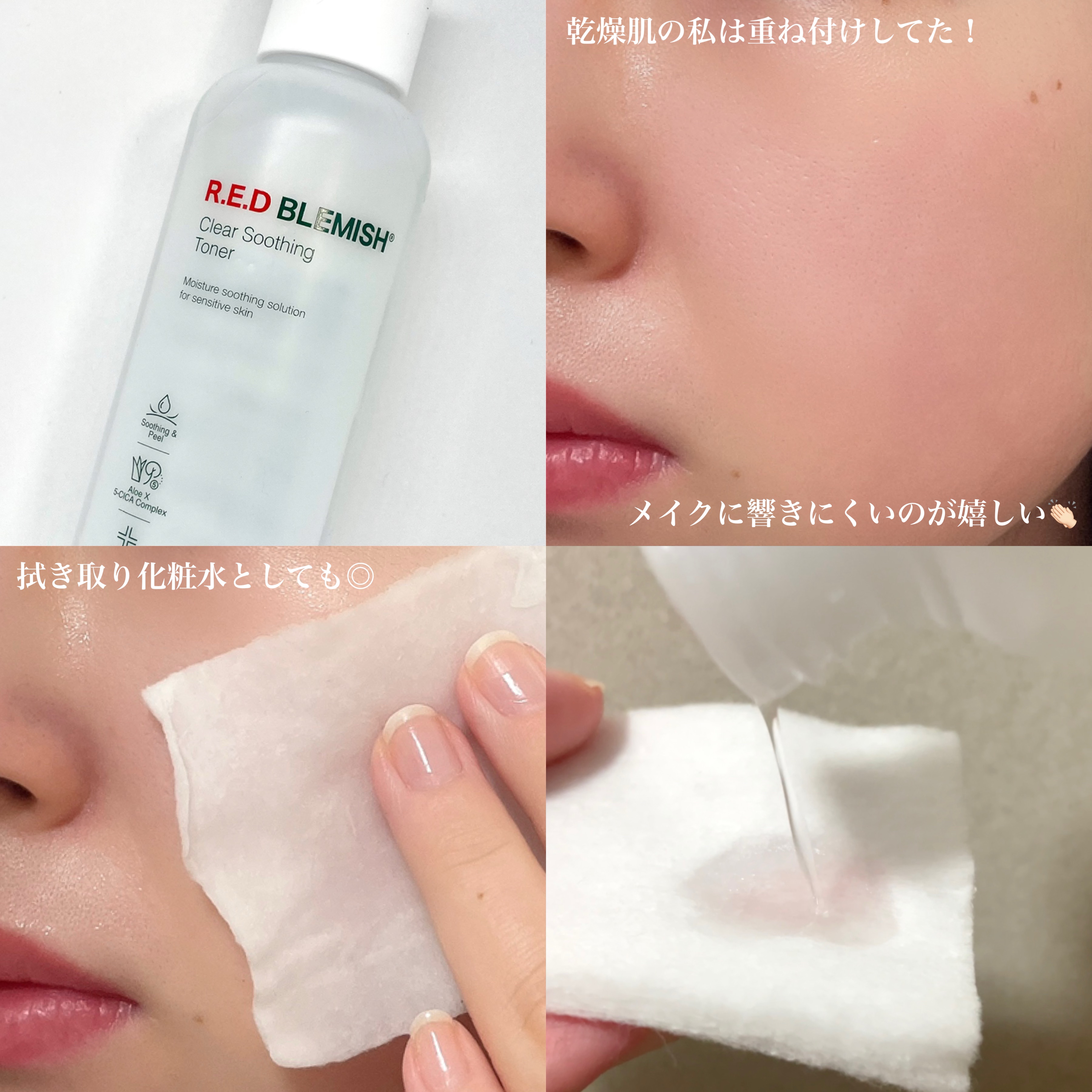 レッドブレミッシュ クリアスージングトナー/Dr.G/化粧水を使ったクチコミ（3枚目）