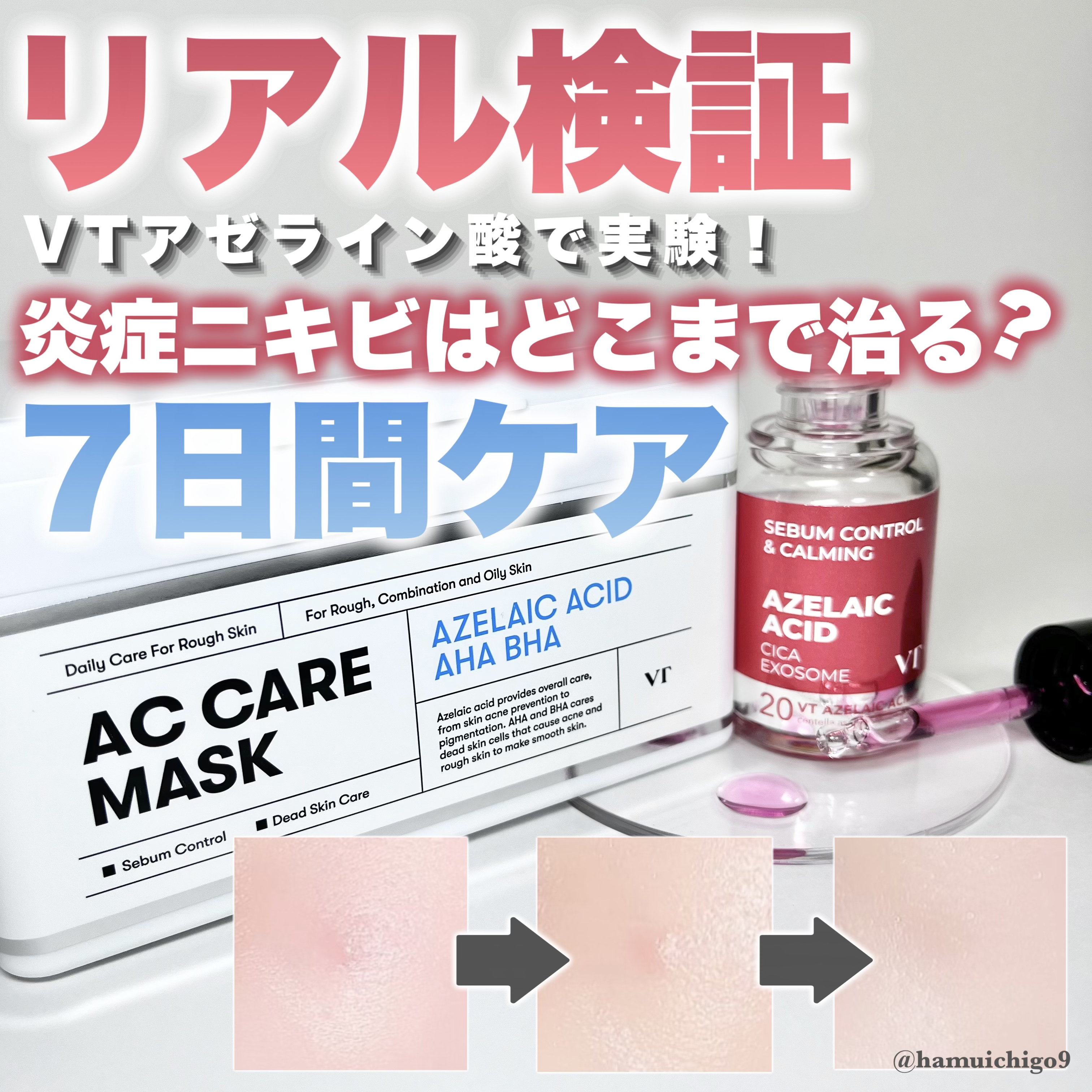 AZケア マスク/VT/シートマスク・パックを使ったクチコミ（1枚目）