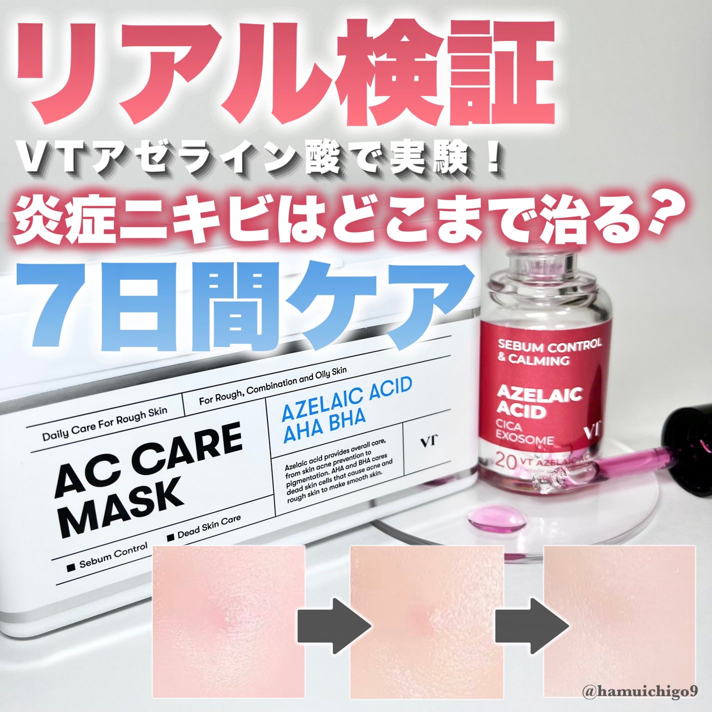 プロCICA クリアスポットパッチ/VT/その他スキンケアを使ったクチコミ(1枚目)