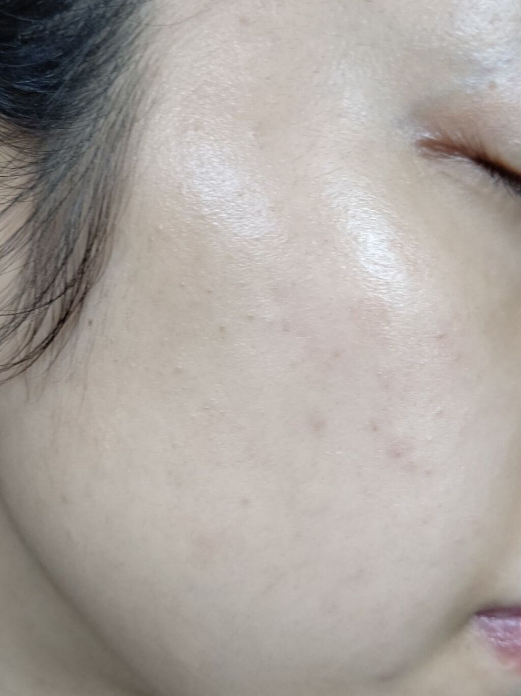 フルコートF(医薬品)/田辺三菱製薬/その他を使ったクチコミ(4枚目)