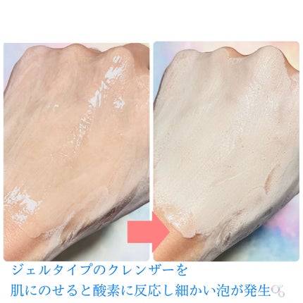 センシティブバブルリラクシングクレンザー/ilso/洗顔フォームを使ったクチコミ(2枚目)