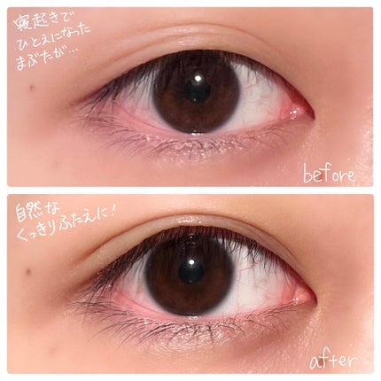 オリシキ アイリッドスキンフィルム /D-UP/二重まぶた用アイテムを使ったクチコミ(2枚目)