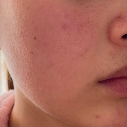 ハトムギ化粧水(ナチュリエ スキンコンディショナー R )/ナチュリエ/化粧水を使ったクチコミ(3枚目)