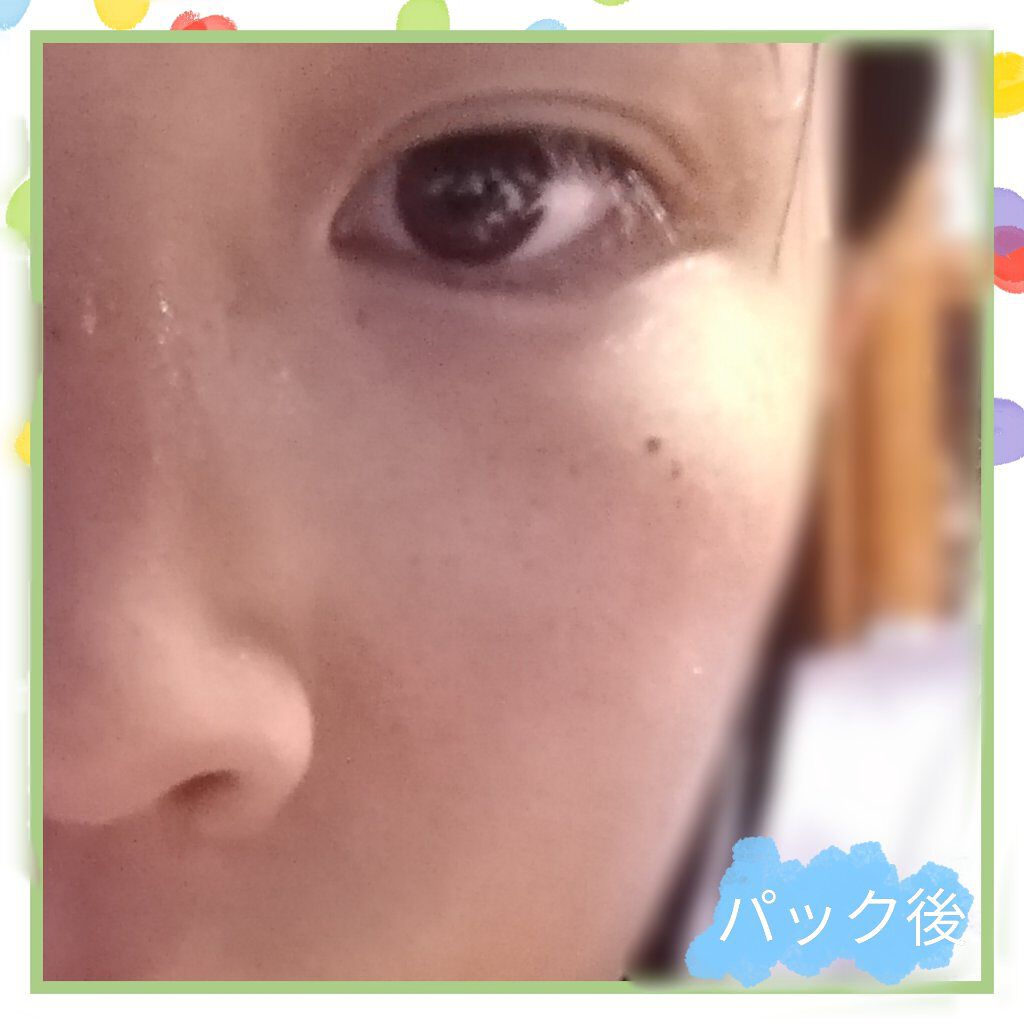 ごめんね素肌マスク/クリアターン/シートマスク・パックを使ったクチコミ(5枚目)