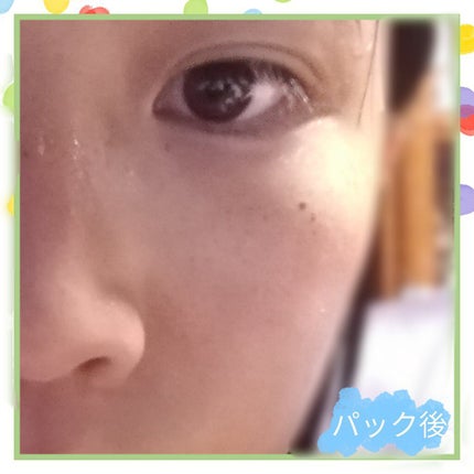 ごめんね素肌マスク/クリアターン/シートマスク・パックを使ったクチコミ(5枚目)