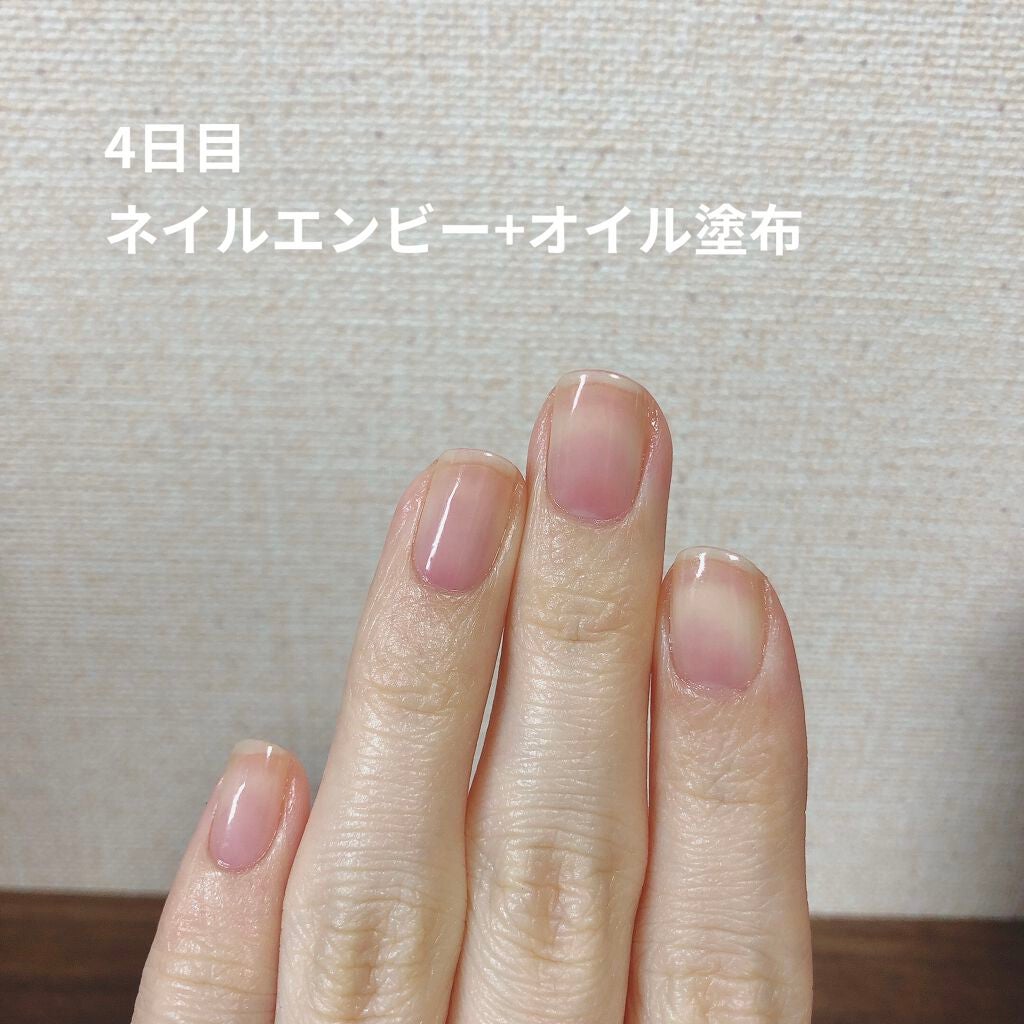 ネイルエンビー/O・P・I/ネイルオイル・トリートメントを使ったクチコミ(6枚目)