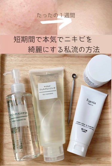 Kiehl's クリーム UFCのクチコミ「脱！繰り返す赤みニキビ‼︎

ぱんぱんに腫れた赤ニキビってなんでこんなに繰り返すんだろう？

.....」（1枚目）