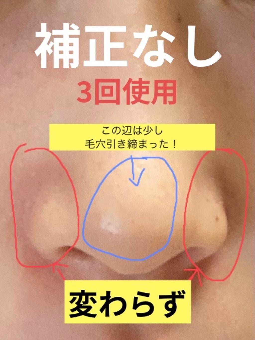 ゼロ毛穴1DAYセラム/MEDICUBE/美容液を使ったクチコミ(4枚目)