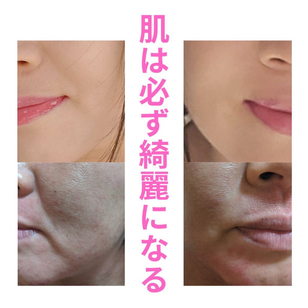 美肌カウンセラー💆肌悩みを解決し見る世界を変える on LIPS 「【肌が綺麗だとドンドン得をする🧙♀️】元々は重度のアトピー性..」(4枚目)